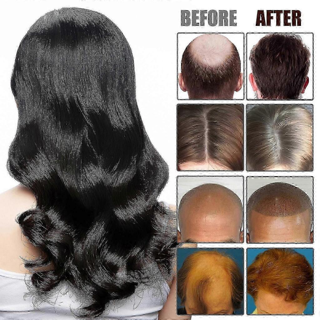 New model EELHOE rosemary hair oil, anti-hair loss, hair care, nourishing, thick and beautiful hair, scalp care oil