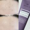 Acleon Youth Acne Skincare Ampoule & Spot Treatment Duo