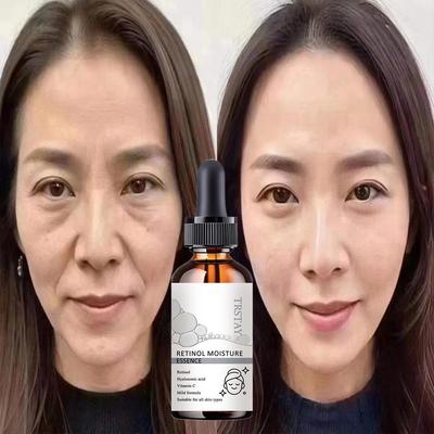 5G/15G/30G/50G/ TRSTAY Spendet Feuchtigkeit und hilft bei der Regeneration der Haut. Geeignet für Gesicht und Körper. Schutzbarriere.