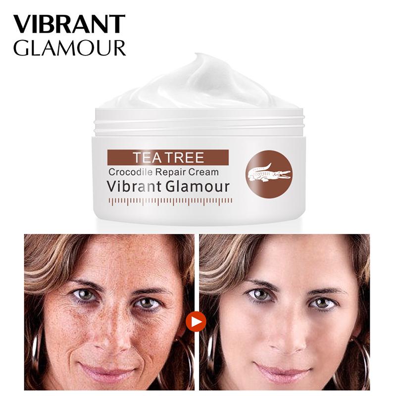 crocodile cream for stretch marks
