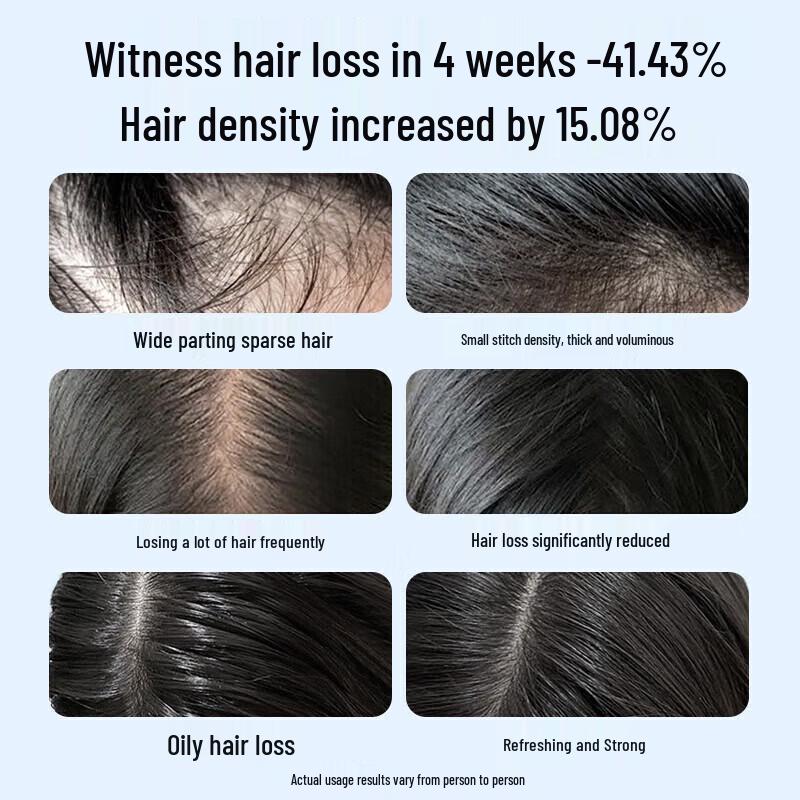 EHD Anti-Hair Loss & Anti-Breakage Shampoo
