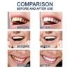 Teeth Whitening Oral Hygiene Teeth Whitening Essence Tooth Bleaching Dental Toothpaste Liquid Essence Oral Care 10ml