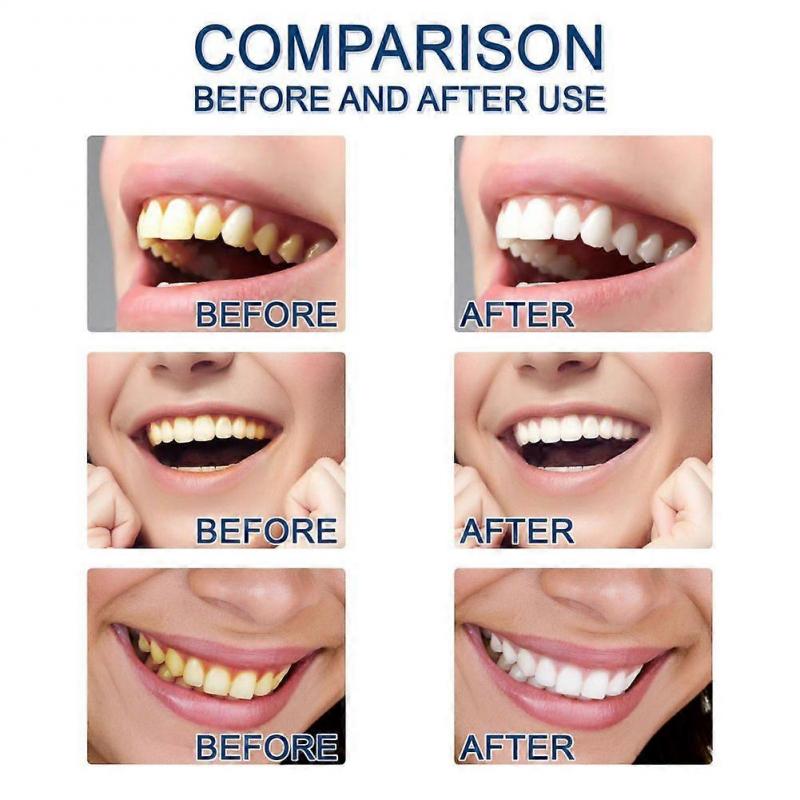 Teeth Whitening Oral Hygiene Teeth Whitening Essence Tooth Bleaching Dental Toothpaste Liquid Essence Oral Care 10ml