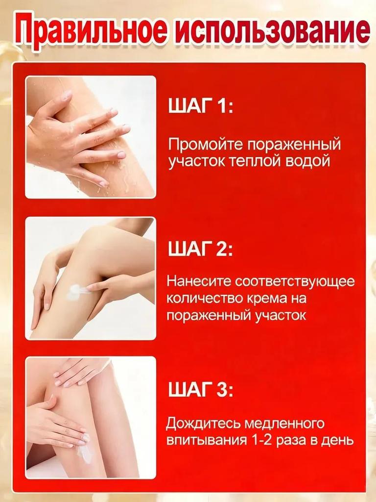 Petzoshenk German Varicose Veins Leg Veins Bulge Dilated Red Blood Cold Compress Gel