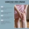 Herbal Varicose Veins Cream Relieves Swelling, Soreness And Reduces Leg Discomfort Anti-Swelling Cream