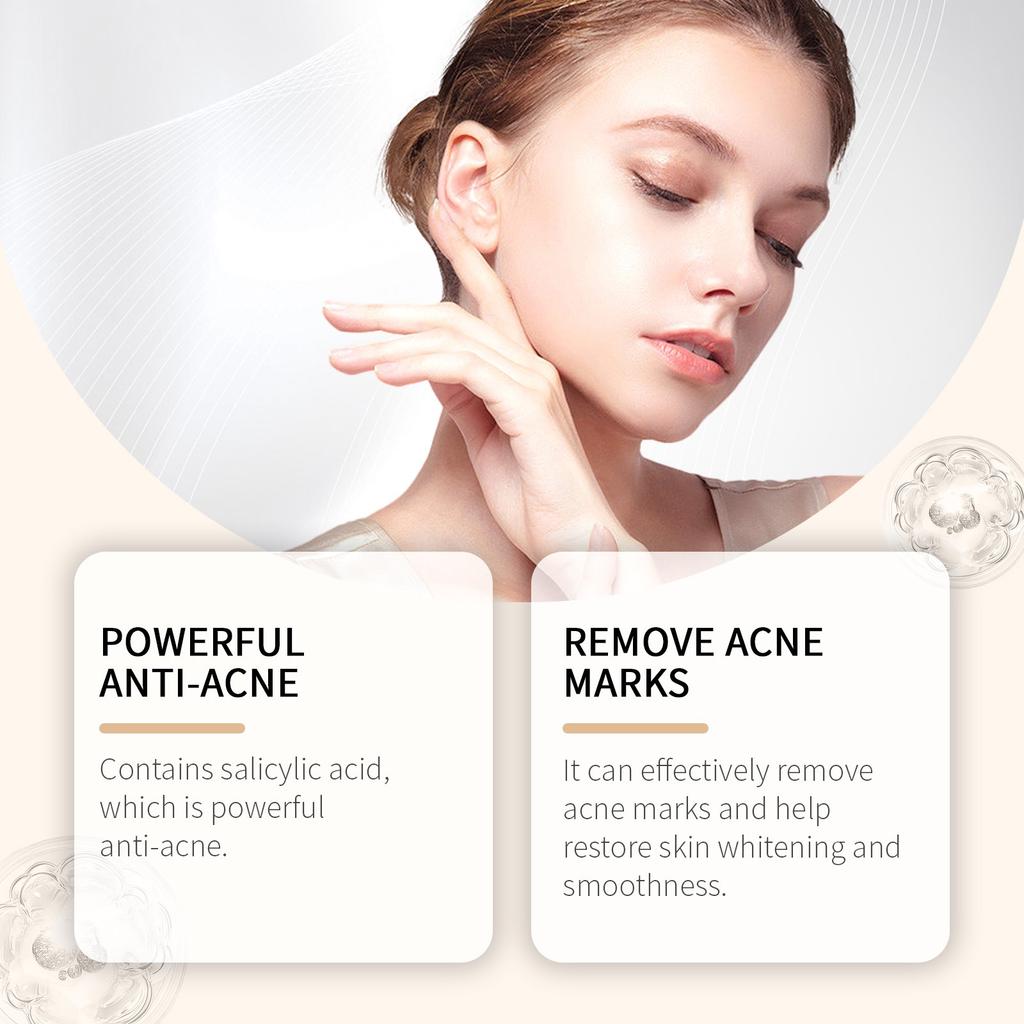 Acne Cream Dot Cream Acne Scar Skin Cream For Natural Gel For The Face  50G