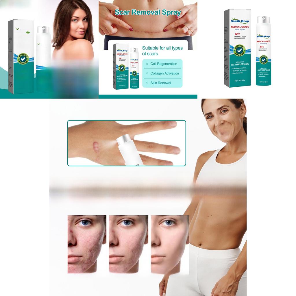 South Moon Scar Care Spray Smooth Skin Healing Reduce Burn Scars Pregnancy Marks
