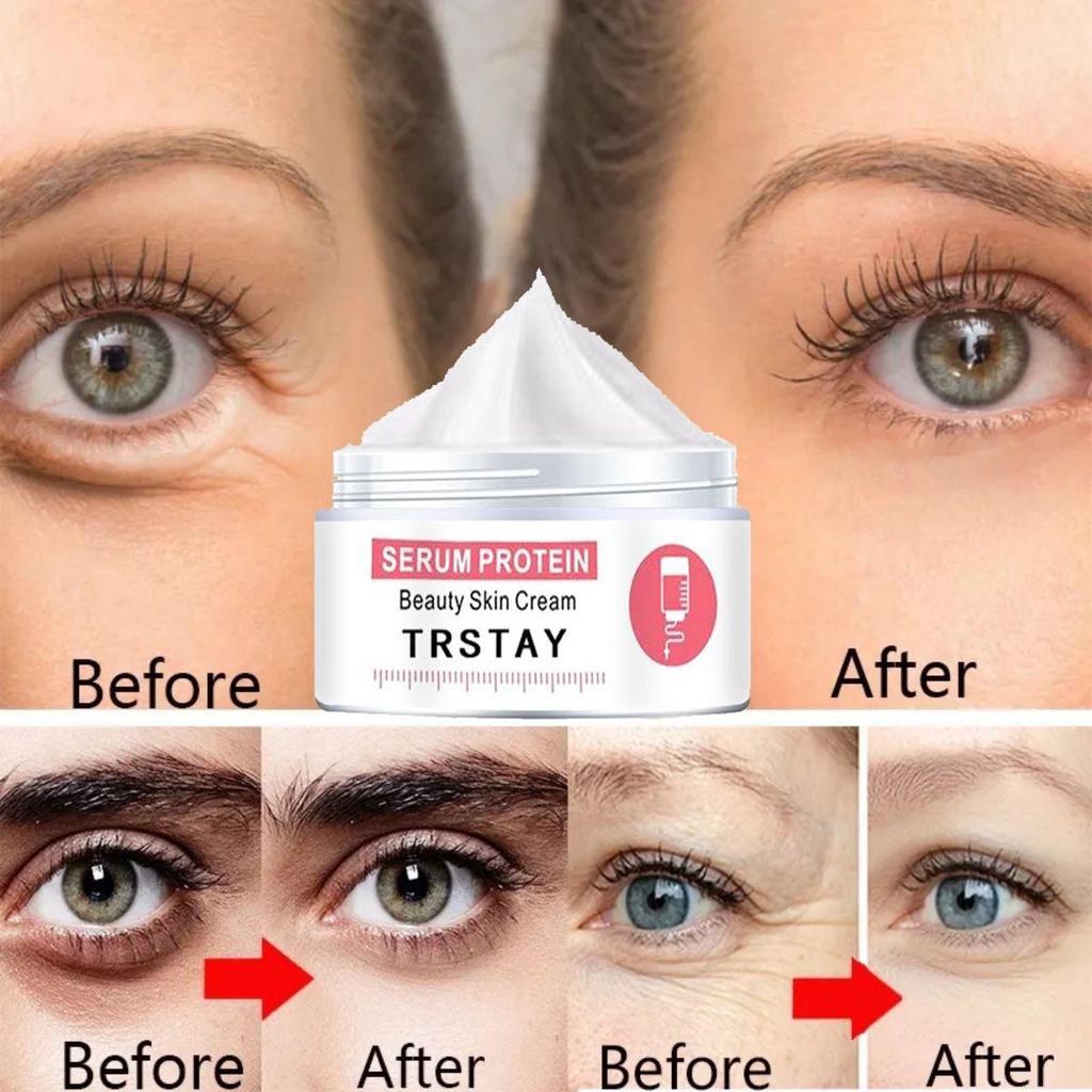 Moisturizing Eye Cream To Brighten Skin Tone, Moisturize, Lighten Dullness, and Firm Skin