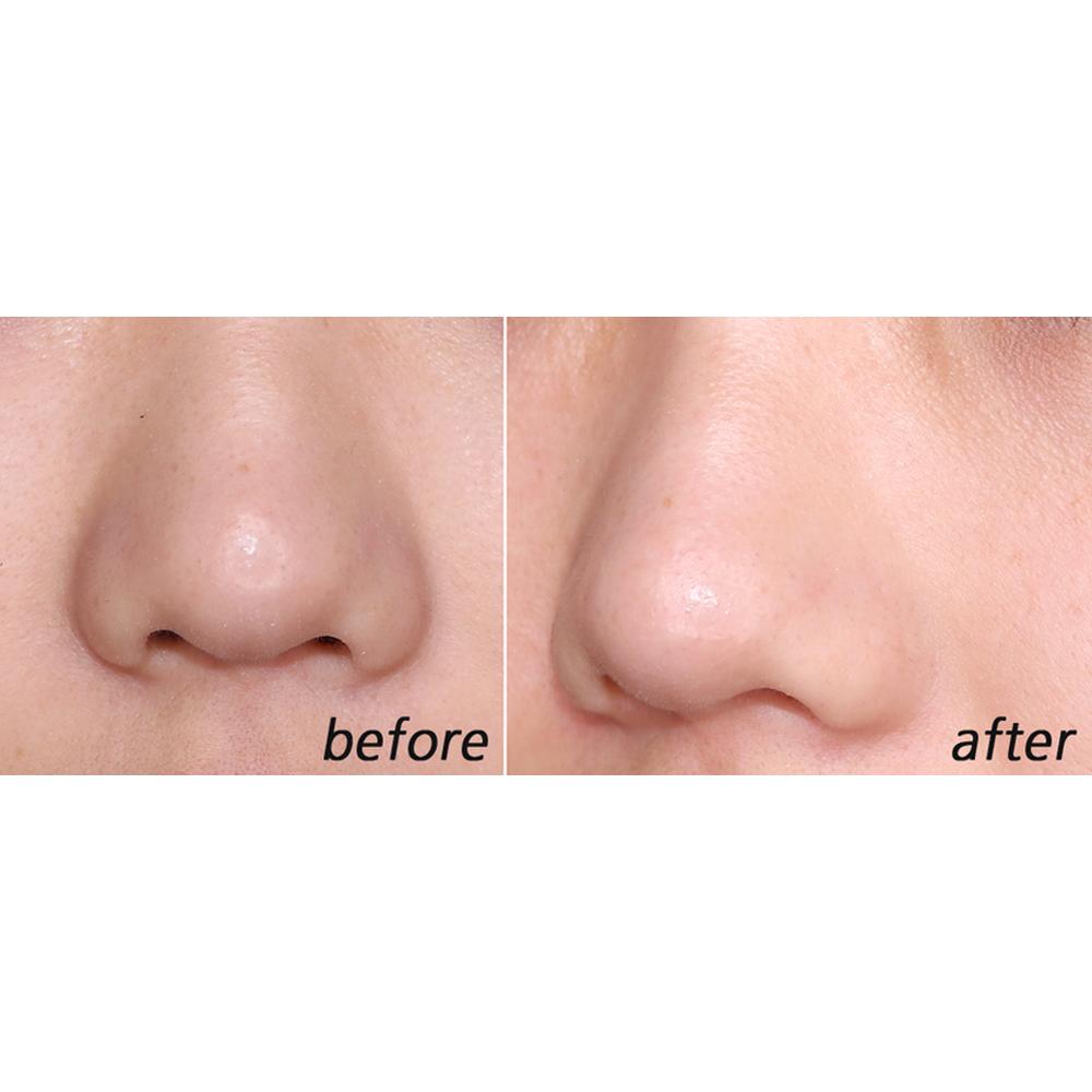 Paula's Choice Skin Perfecting 2% BHA Liquid Exfoliant 236ml - Blackhead Pore Care, Korean