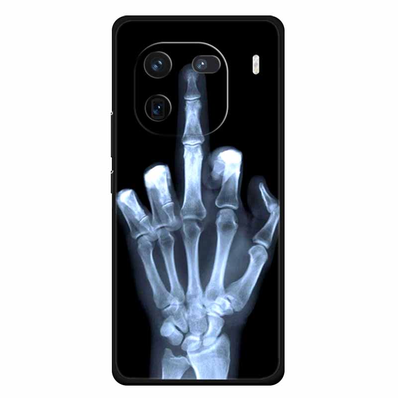 Für Vivo Iqoo 12 Hülle Weiches Silikon Niedliche Katze Löwe Bedruckte Hüllen für Vivo iQOO 12 Pro Hüllen Luxuriöse Schutzhüllen Iqoo12