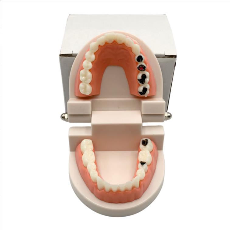 Modelo Dental No Extraíble con 28 Dientes