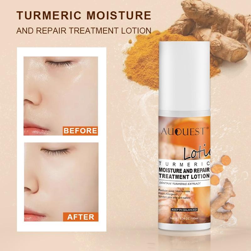 Buy AuQuest Face Toners Moisturizing Whitening Acne Treatment Removal