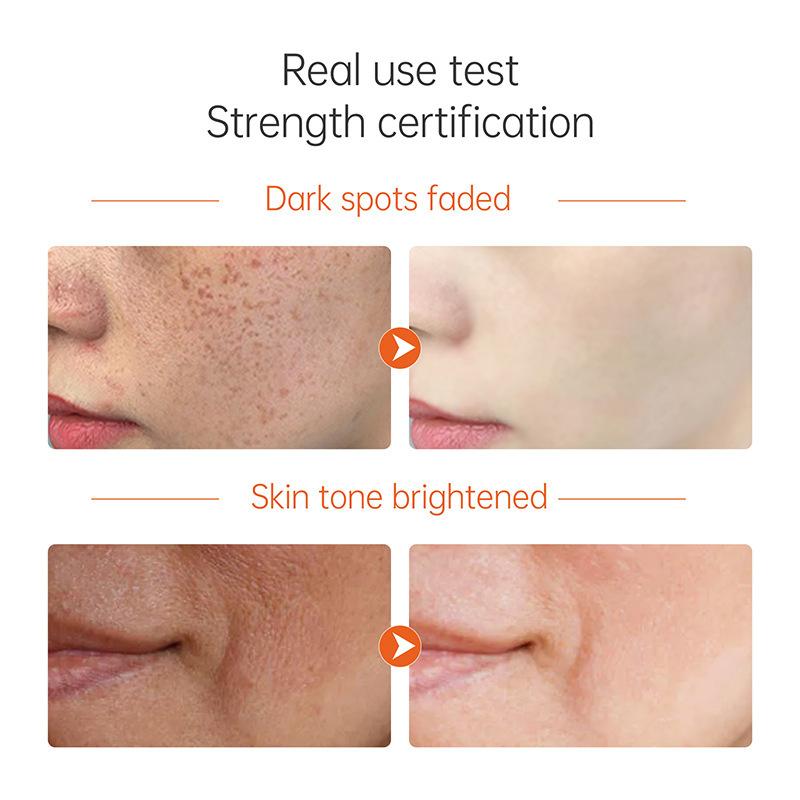 VC Essence feuchtigkeitsspendende und aufhellende Hautfarbe, Reparatur stumpfer Haut, Gesichtspflege, Vitamin-C-Essenz, Originallösung