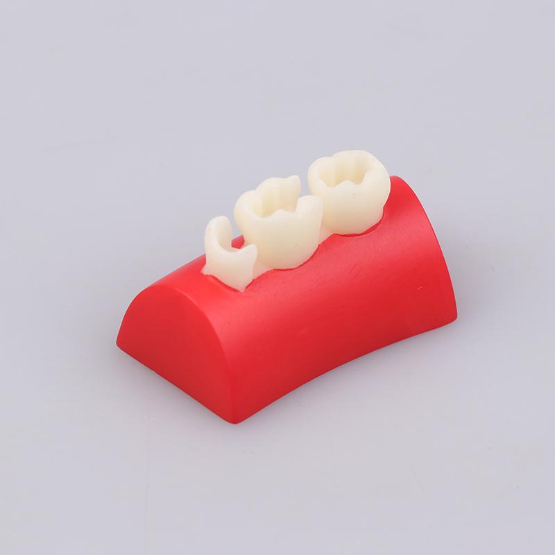 

Dental Inlay Exercise Model Block Filling Exercise Resin Materials Oral Filling Model For Dentistry Teaching Stud Tool