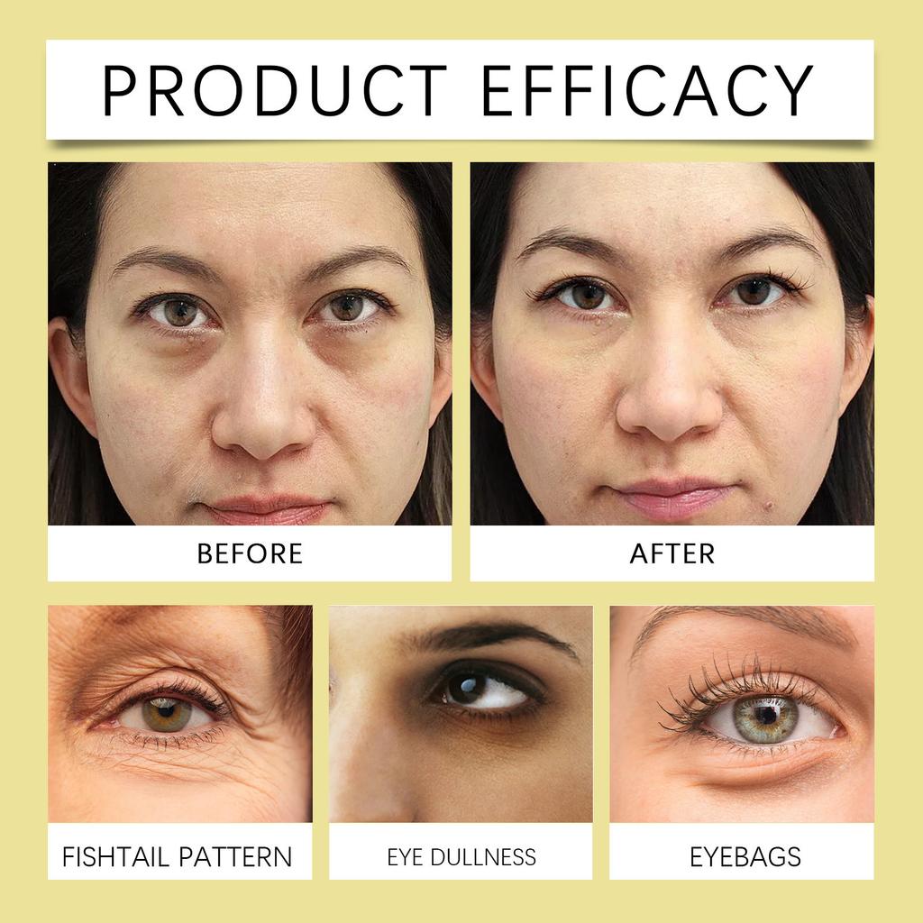 Šviesinantis paakių tamsius ratilus gelis, gerinantis paakių sritį, gerinantis papilkėjusią paakių odą, stangrinantis ir glotninantis gelis, 50g