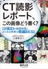 How To Write a CT Image Reading Report? - Basic Knowledge of Anatomy and Findings, and Examples of Reports for Common Diseases