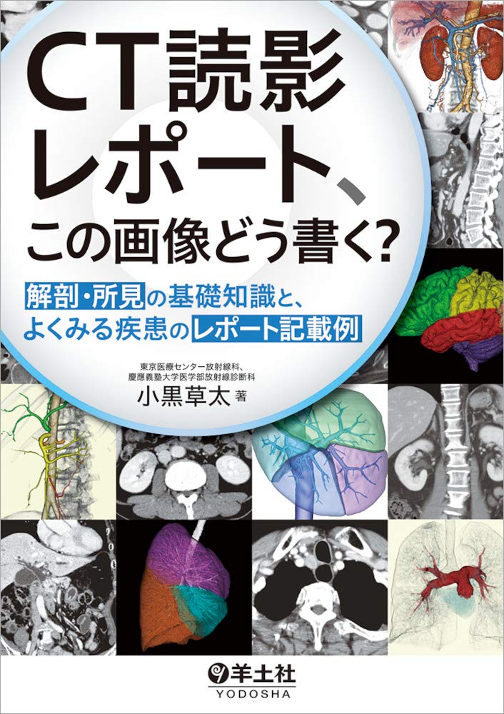 How to write a CT image reading report? - Basic knowledge of anatomy and findings, and examples of reports for common diseases