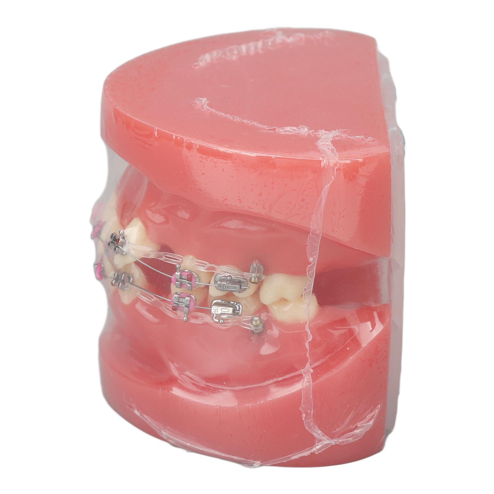 

Demonstration Orthodontics Dental Model Disassembled Resin Teeth Model for Teaching Research