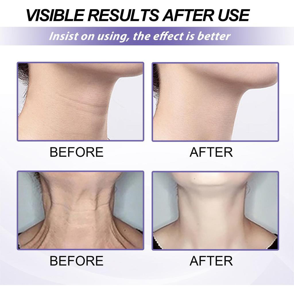 EELHOE Retinol Neck Cream Lightens Neck Lines, Moisturizes & Firms Neck Skin Neck Massage Cream