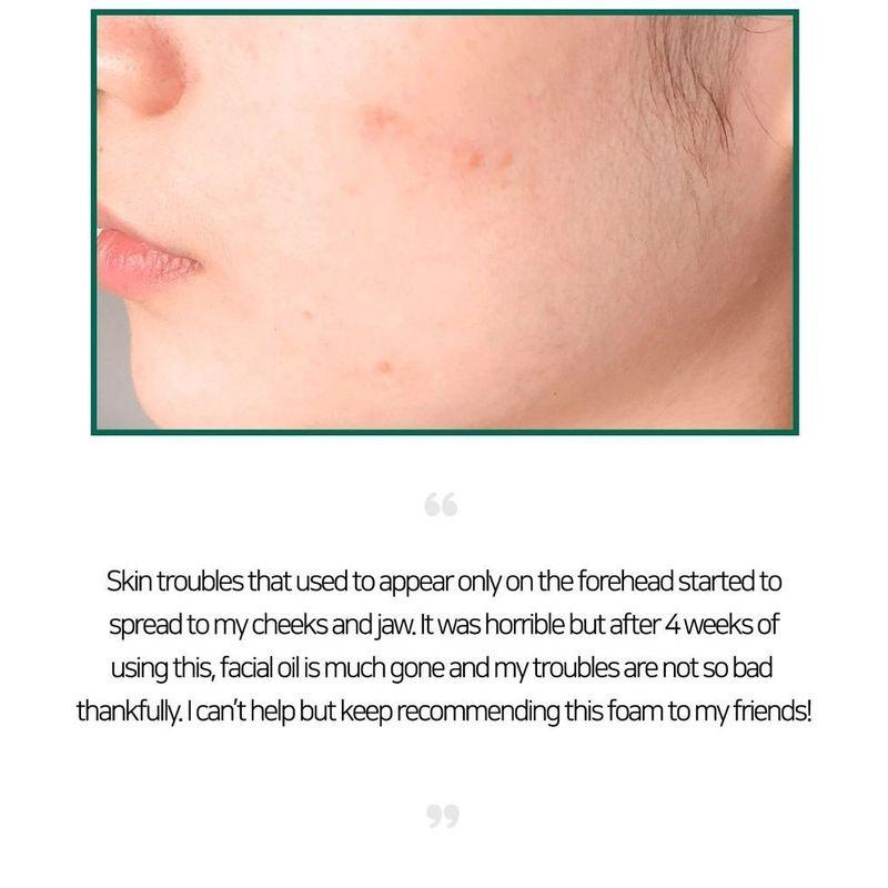 SOME BY MI - AHA,BHA,PHA 30 Days Miracle Acne Clear Foam Mini