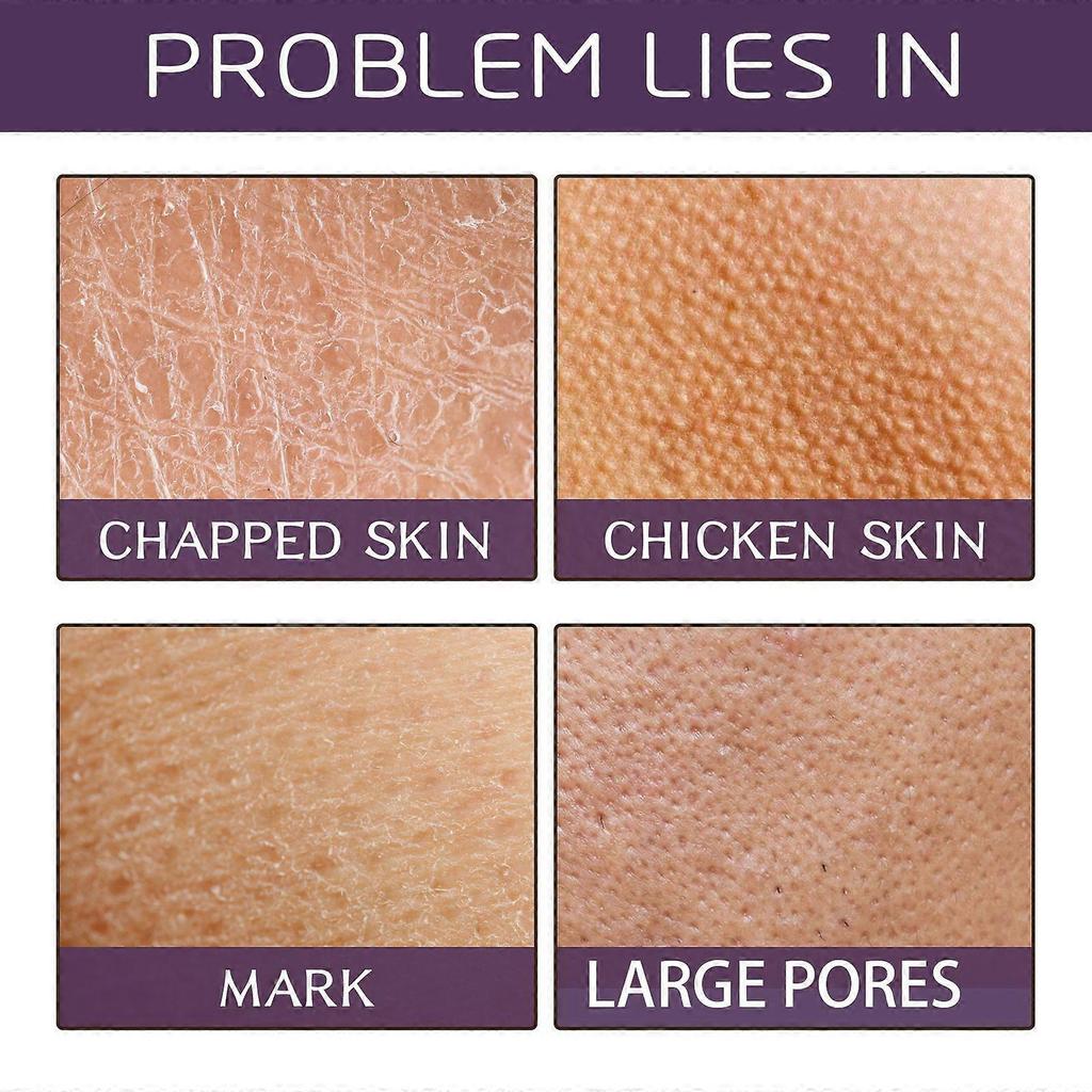 Limited time!!Eelhoe Niacinamide Blackberry Body Scrub - Skin Cleansing, Exfoliating Dead Skin, Melanin Care, Beauty Body Scrub