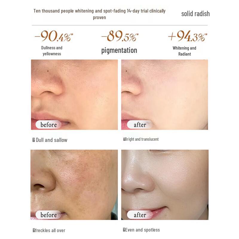 NAIXI Japan 377 Niacinamide Whitening & Spot Reducing Mask