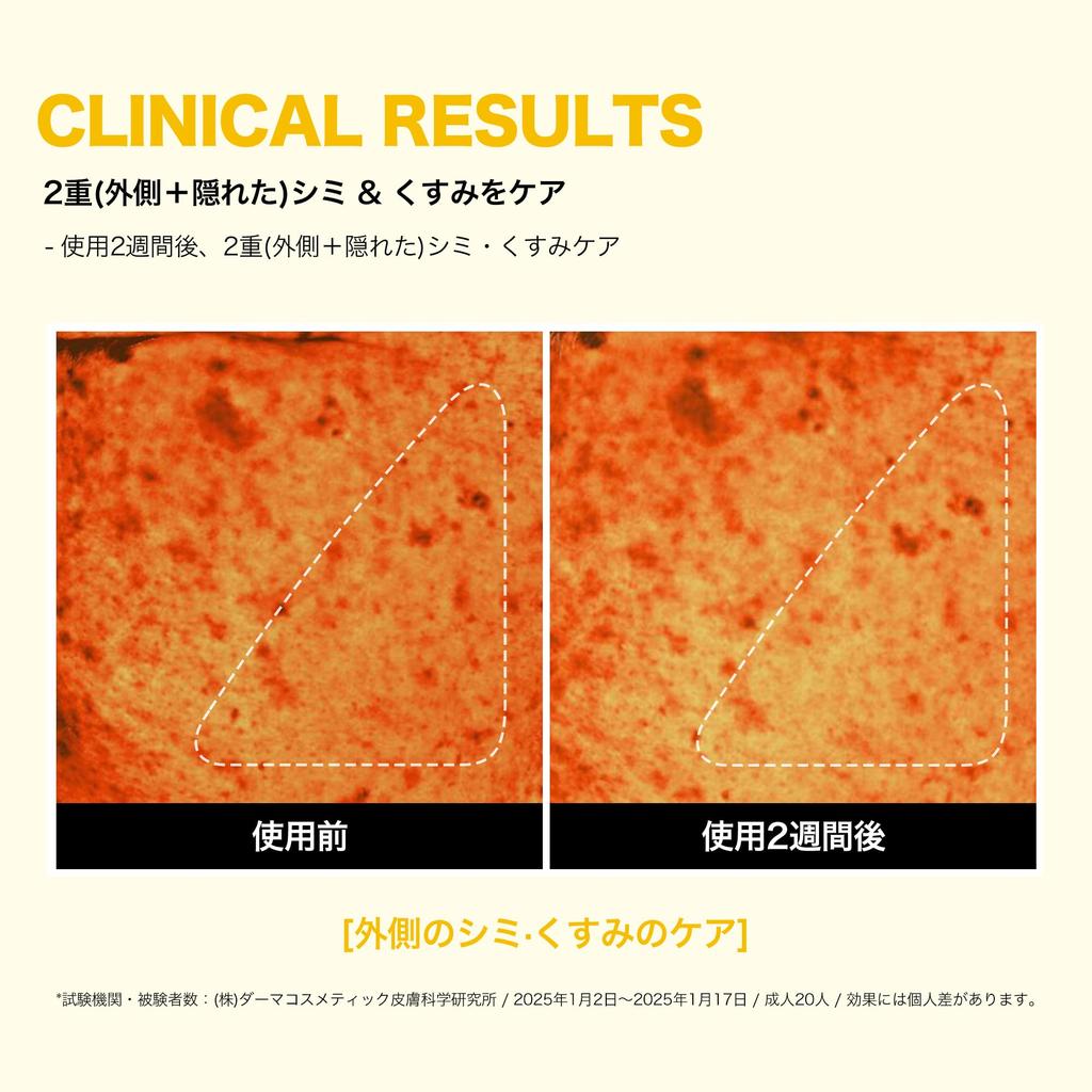 SOME BY MI Yuja Niacin Daily Mask Face mask with yuzu fruit and vitamin Korean Anti-Blemish (30 sheets, 370ml) - niacinamide, extract, arbutin, C.