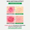 WELLAGE Cica Calming Cream 80ml - Korean Face Soothing Moisturizer, High Purity Madecassoside With Centella Asiatica Panthenol - Calms Sensitive Skin