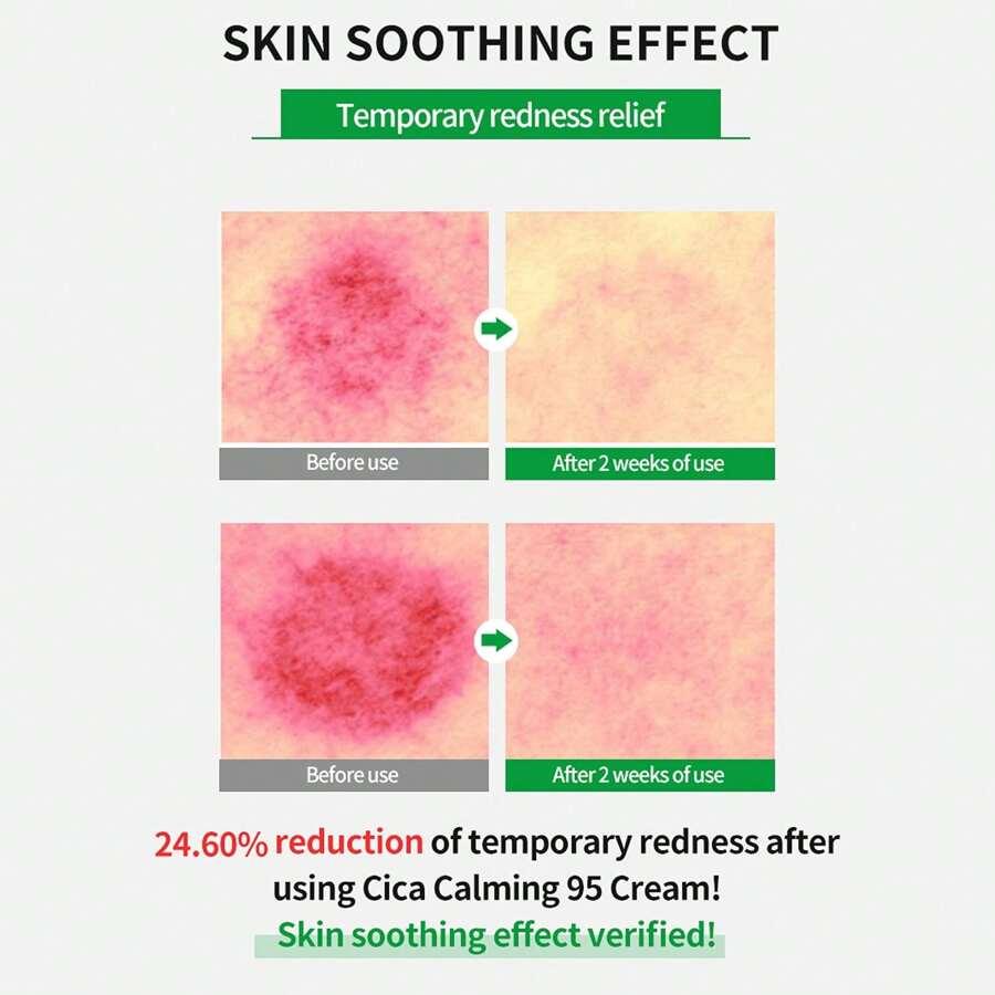 WELLAGE Cica Calming Cream 80ml - Korean Face Soothing Moisturizer, High Purity Madecassoside With Centella Asiatica Panthenol - Calms Sensitive Skin