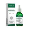 Limited time!!Ouhoe Salicylic Acid Pore-Tightening Essence Gently Repairs, Cleanses Pores, Removes Blackheads And Brightens The Skin