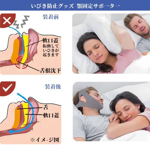 Industry-leading Anti-snoring Aid: Chin Support, Anti-snoring Tape, Mouth Closure Tape, Sleep Aid, Odorless, Breathable, Skin-friendly Fabric, Adjusta