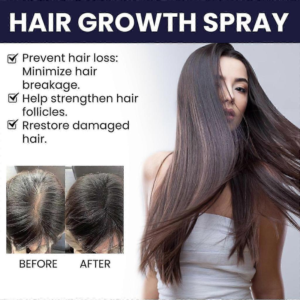 1-3x 50ml Ouhoe Hair Growth Spray Moisturizes Scalp Hair Damaged Strong Hair Dense Hair Growth Spray