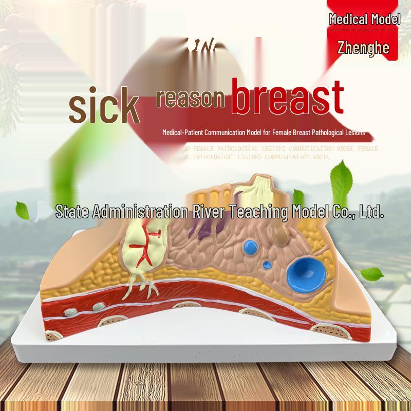 Breast Lesion & Anatomy Model for Breastfeeding Training 16x13x12 cm
