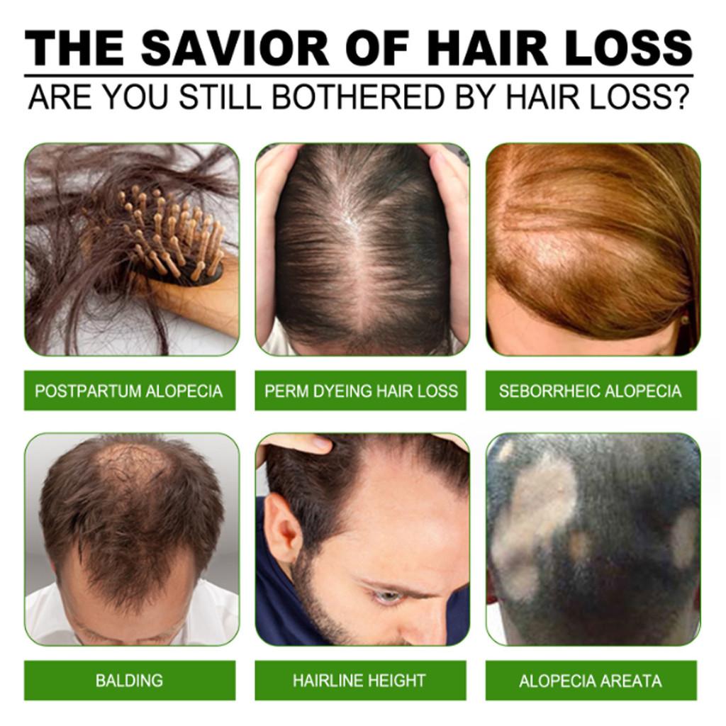 South Moon Ginger Infused Hair Growth Roll-on Oil For Nourishing Scalp And Strengthening Roots