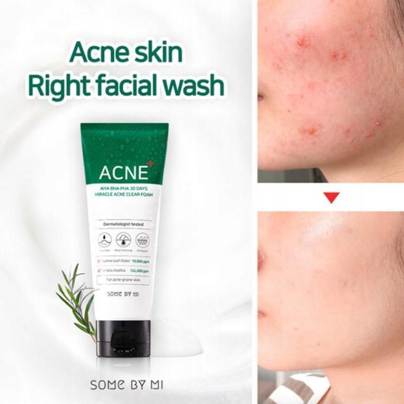 Some By Mi Aha Bha Pha 30 Days Miracle Foam Cleansing Foam 100
