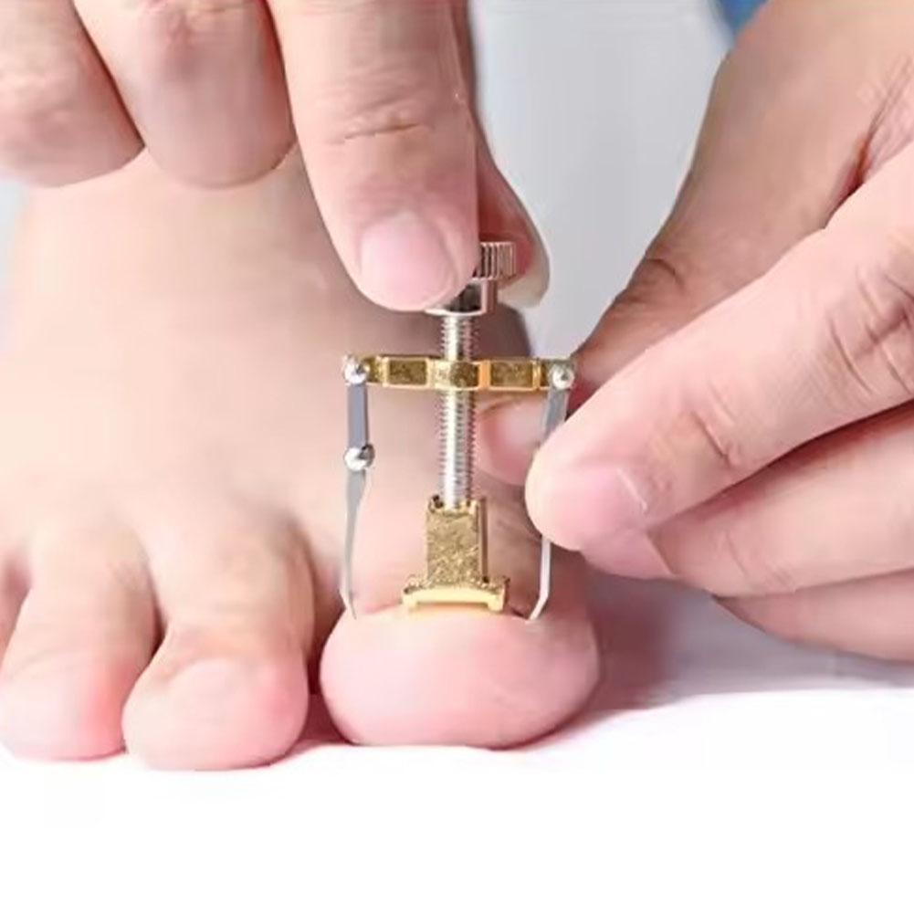 1-5pcs Ingrown Toenail Corrector Straightening Clip Pedicure Foot Nail Care Tools Pedicure Toenail Fixer Nail Pedicure Clipper