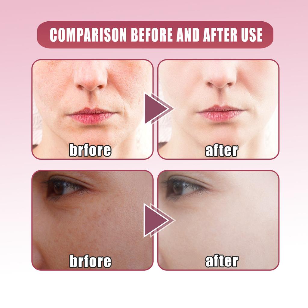 Beet VA Serum Turmeric Dual Ingredient Facial Skin Care Oxidizing Liquid Essence