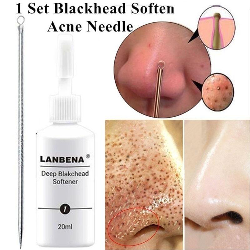 stratum corneum blackhead removal