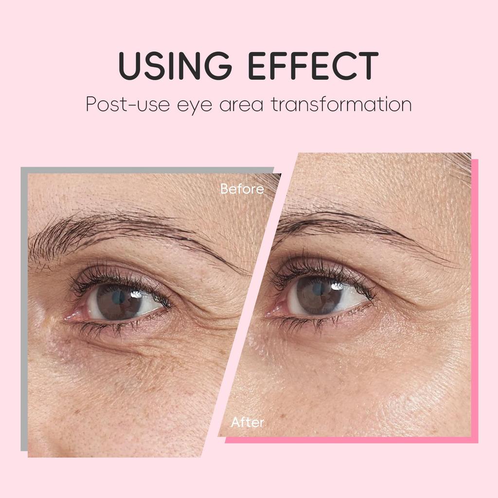 LAIKOU Sakura Faltenreduzierende Augencreme mit Roll-Applikator Schnelltrocknend Feuchtigkeitsspendend Hyaluronsäure Erfrischendes Augen-Serum 15ml