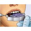 GDC Dentulous Non-Perforated Impression Trays Upper # 1 (Itrldnpu1)