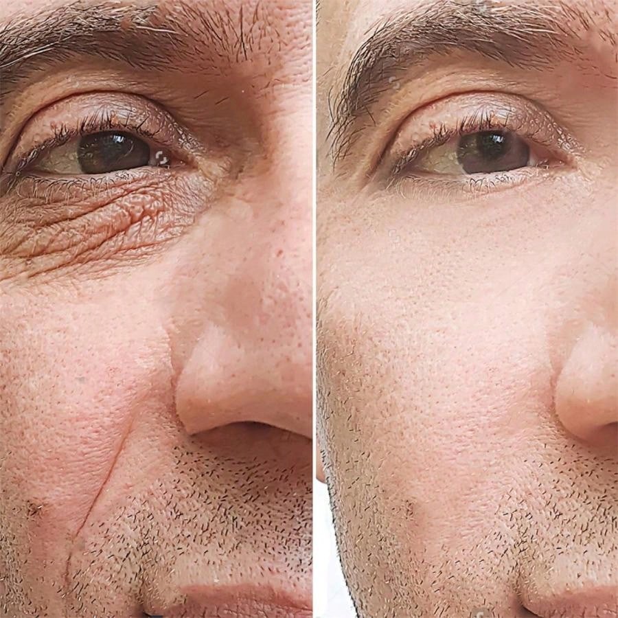 5g/15g/30g/50g /60gRelief Pain Back Pain Muscle Aches Sprain Arthritic Pains Muscle Pain Cream