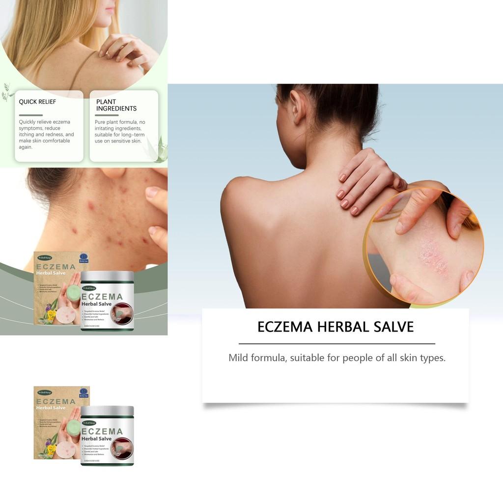 Woodsleep Kräutercreme Natürliche Formel Beruhigende Feuchtigkeitscreme Zur Linderung von Hautrötungen