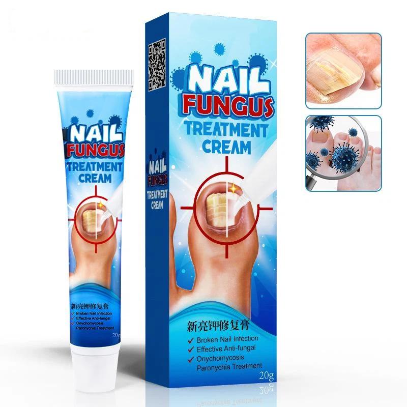 Nail Treatment Cream Antibacterial Repair Ointment Whitening Toe Anti Infection Nail Repair Cream Nail Care