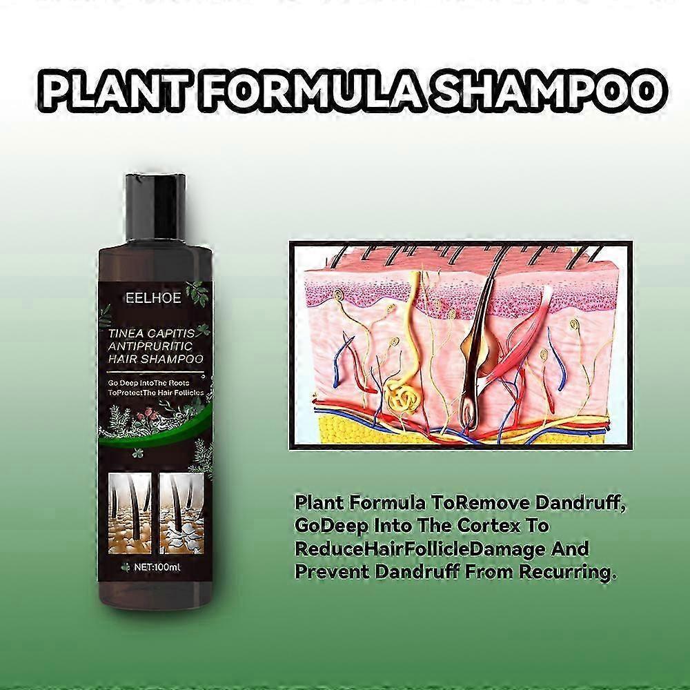 EELHOE Anti-tinea and Anti-itching Shampoo, Anti-hair Loss, Refreshing, Oil-controlling, Anti-dandruff and Anti-itching Shampoo