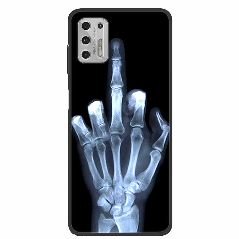 For Moto G Stylus 2021 Case Shockproof Soft silicone TPU Back Cover For Motorola Moto G Stylus 5G Phone Cases GStylus 2022