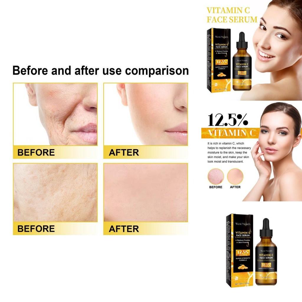 West Month Vitamin C Facial Serum For Radiant Skin Tightening And Smoothing With Moisturizing Benefits