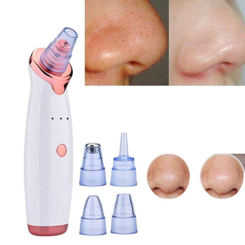 2020 Model Electric Blackhead Vacuum Cleaner For Deep Pore Cleansing And Care