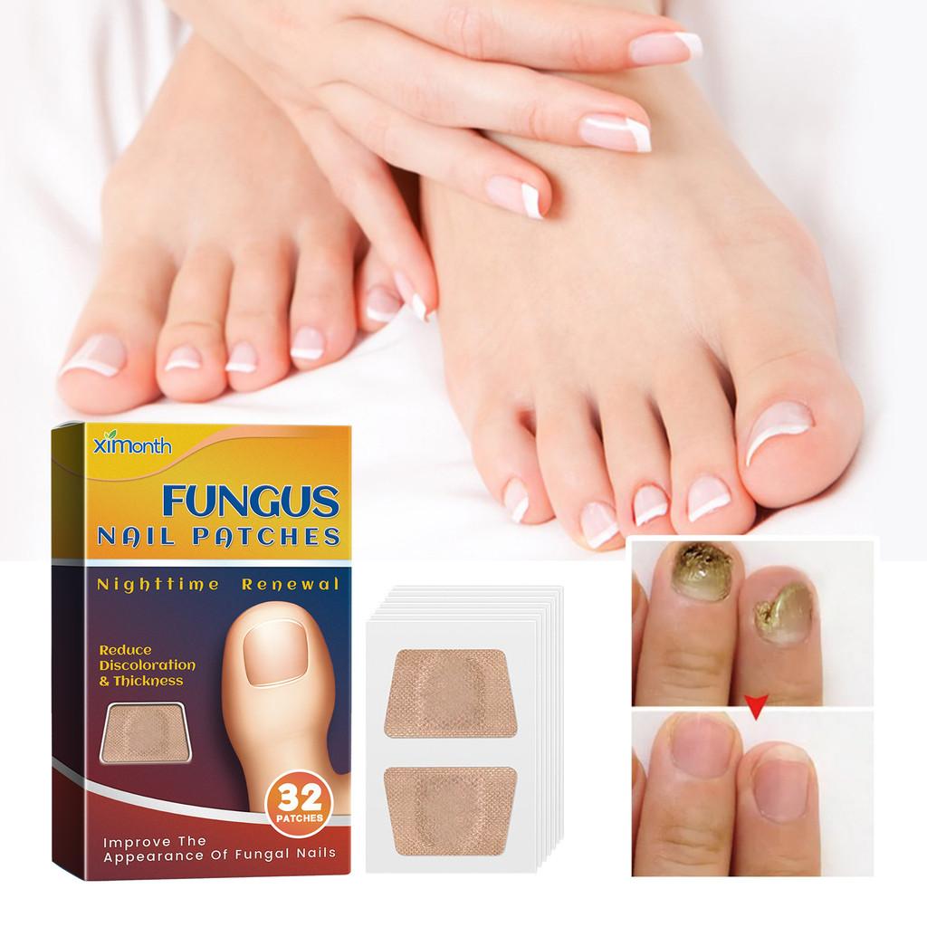 Ximonth Nagelpflege-Pflaster für gesunde Zehen und starke Nägel mit reparierender Formel