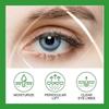 Eye Care Serum - Reduces Dark Circles & Fine Lines, Hydrating Essence with Aloe & Coffee Extract, 30ml