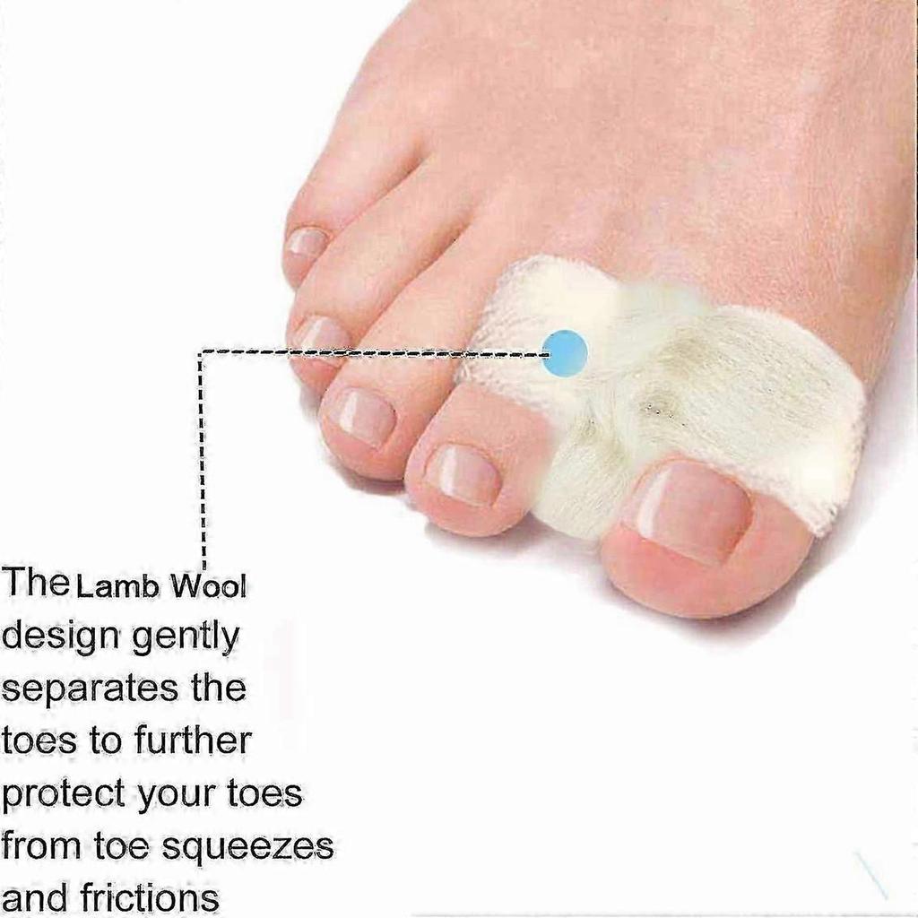 4 Bags Lambs Wool Toe Splint Cushions for Toes, Soft Feet Lams Wool Toe